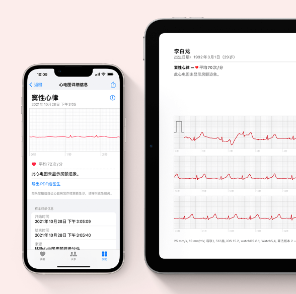 苹果官宣 Apple Watch 心电图 ECG 功能，详细的使用方法来了